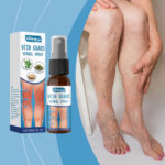 Varicose Veins Treatment Spray Relief Spray