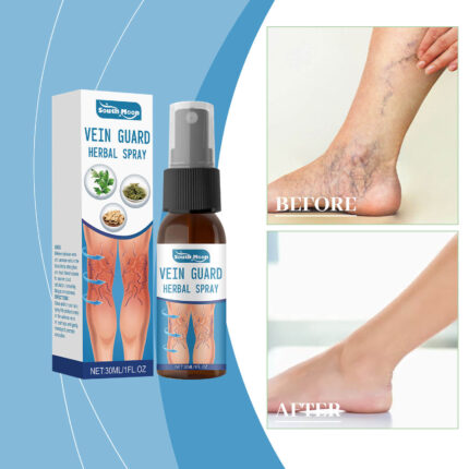 Varicose Veins Treatment Spray Relief Spray