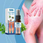 Varicose Veins Treatment Spray Relief Spray